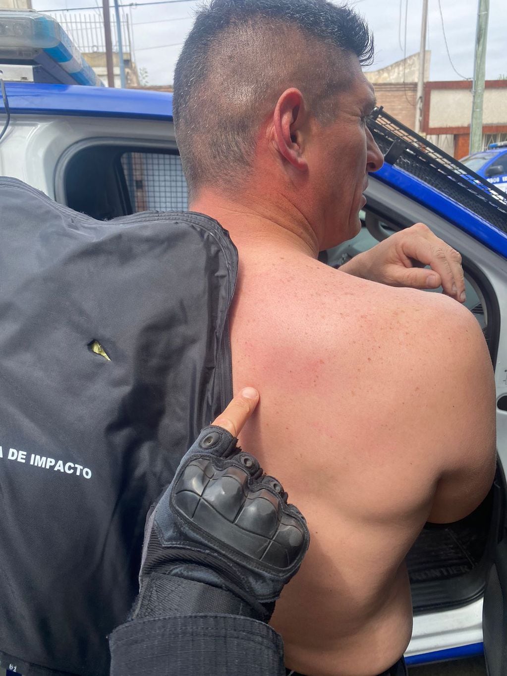 El agente herido este lunes en Alta Córdoba. (Gentileza Policía)