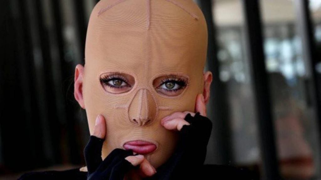 Dana Vulin la australiana que había sido atacado por una mujer celosa y  la quemó viva. Tras una exitosa cirugía de reconstrucción facial recuperó su rostro.