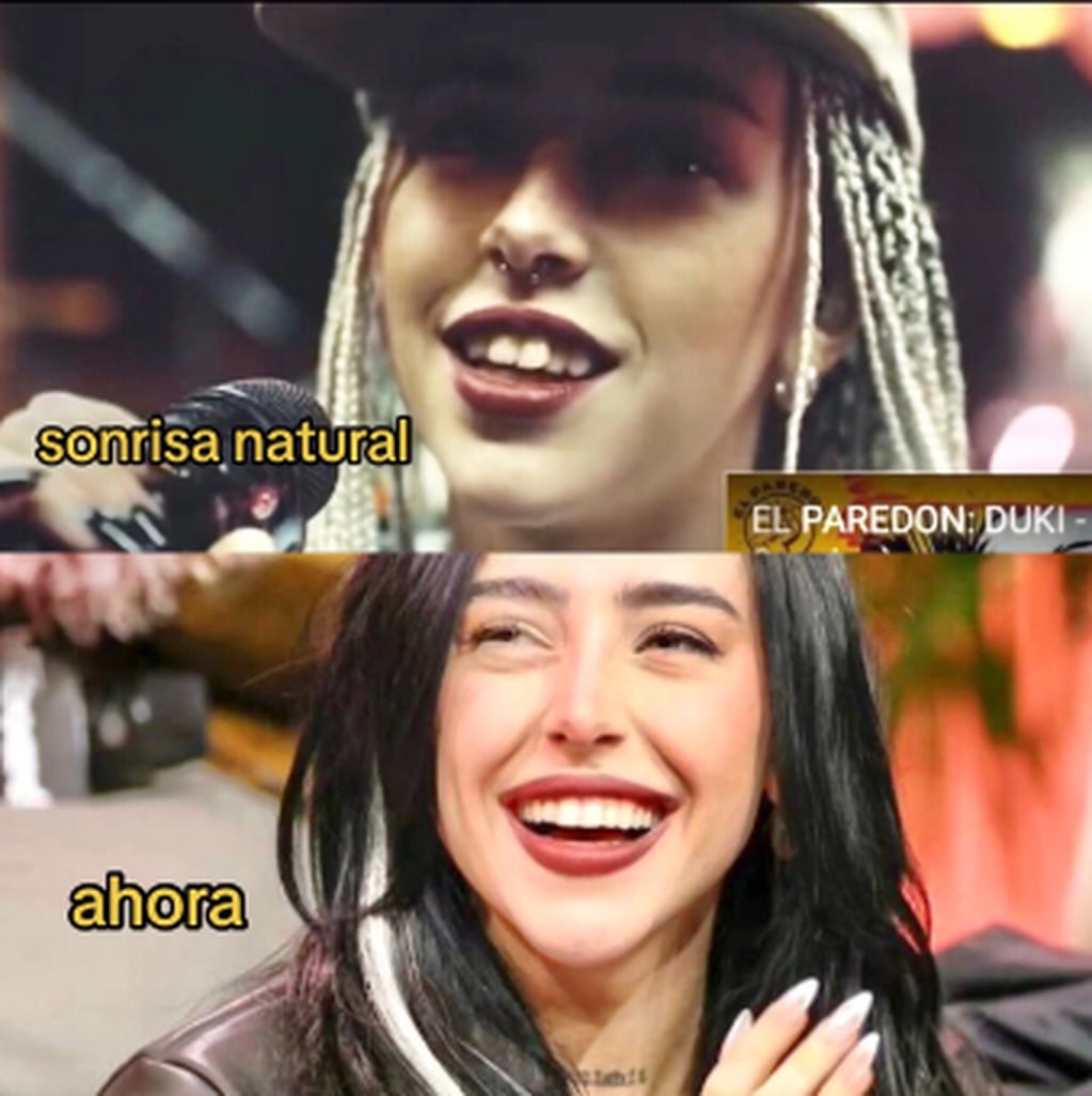 El antes y después en la sonrisa de Nicki Nicole