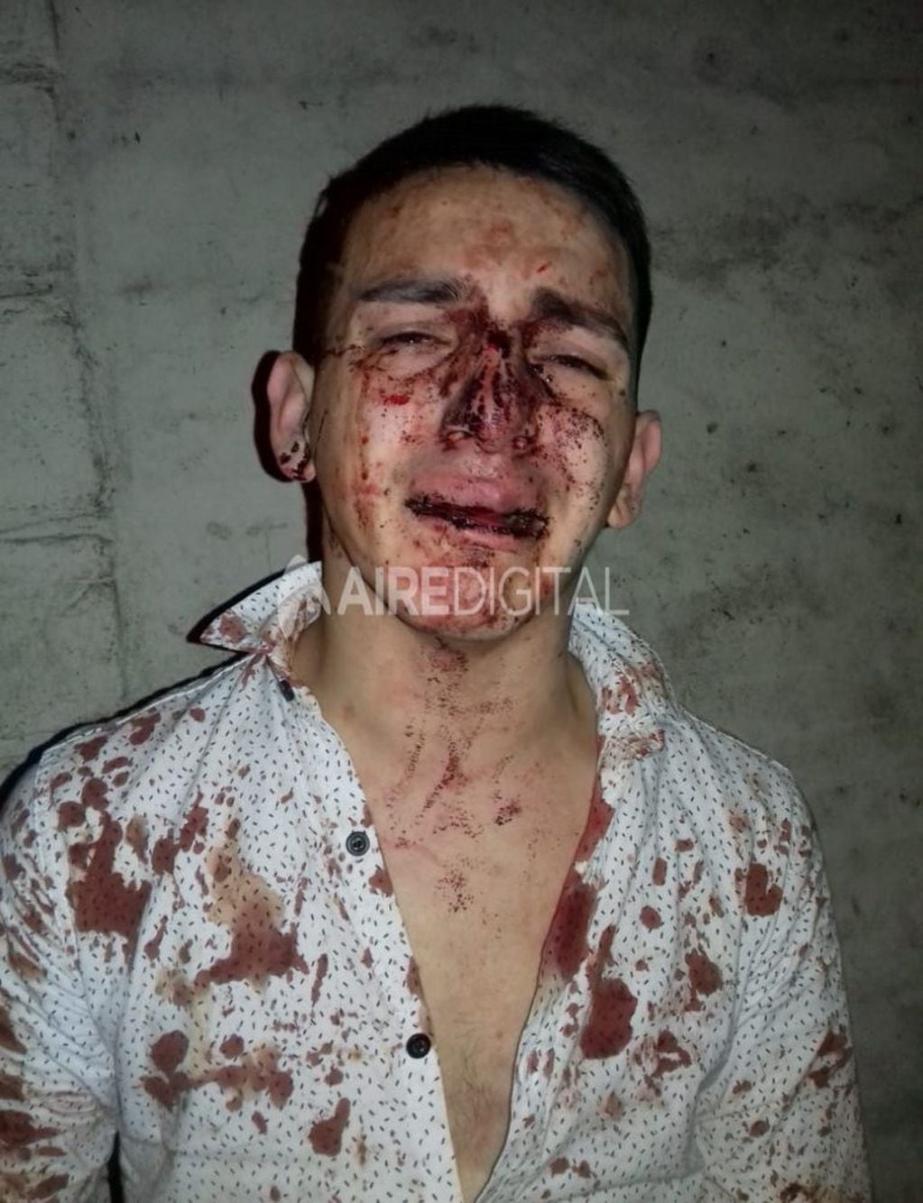 Ezequiel, joven golpeado en un boliche santafesino. (Aire de Santa Fe)