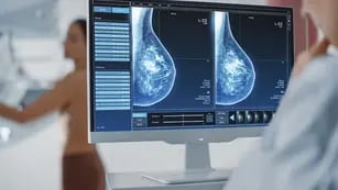 Mamografía cáncer de mama