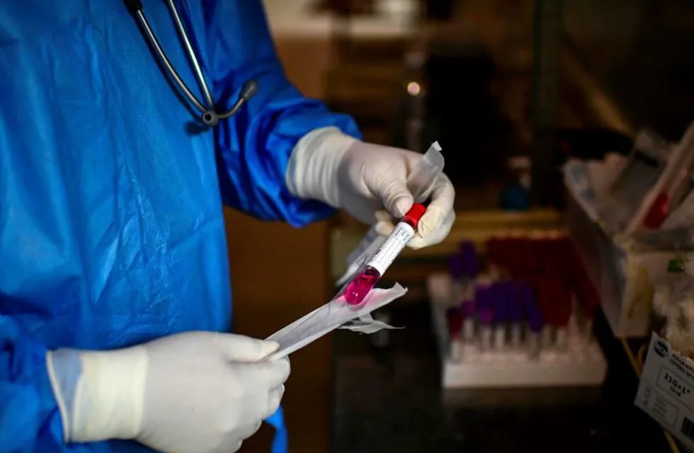 Un doctor una muestra de hisopo para la prueba de COVID-19 en el Hospital Público Doctor Alberto Antranik Eurnekian de Ezeiza. (Foto de RONALDO SCHEMIDT / AFP)