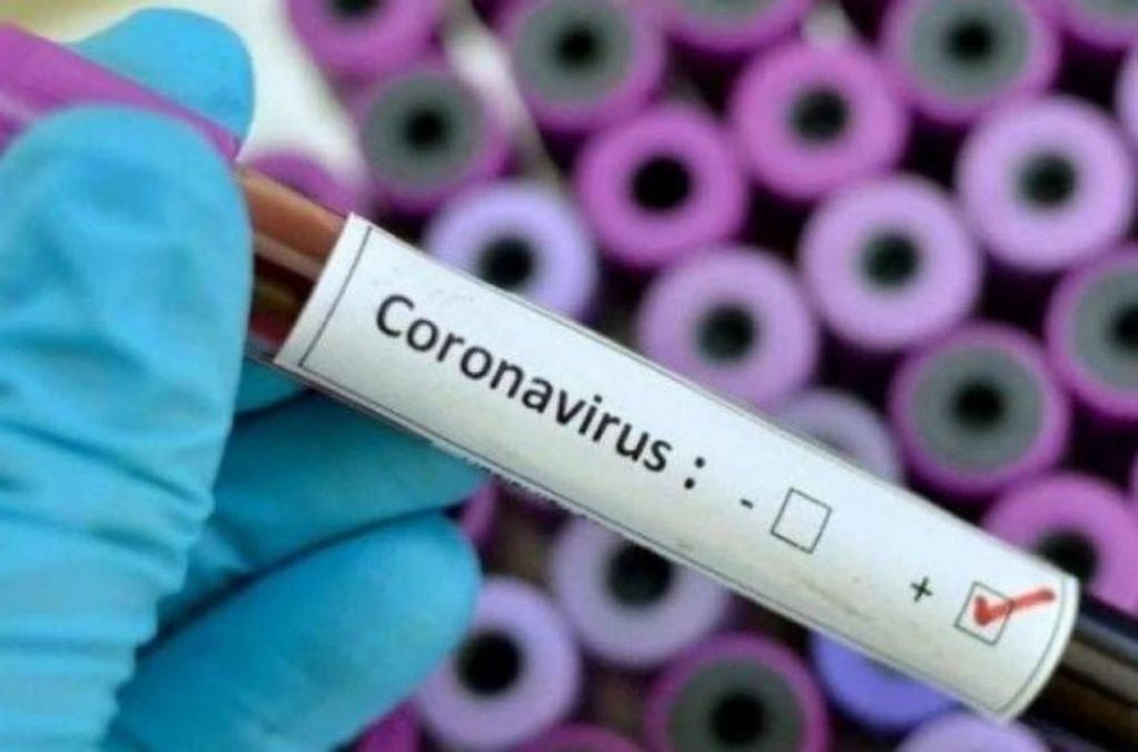 Test coronavirus. (Archivo)