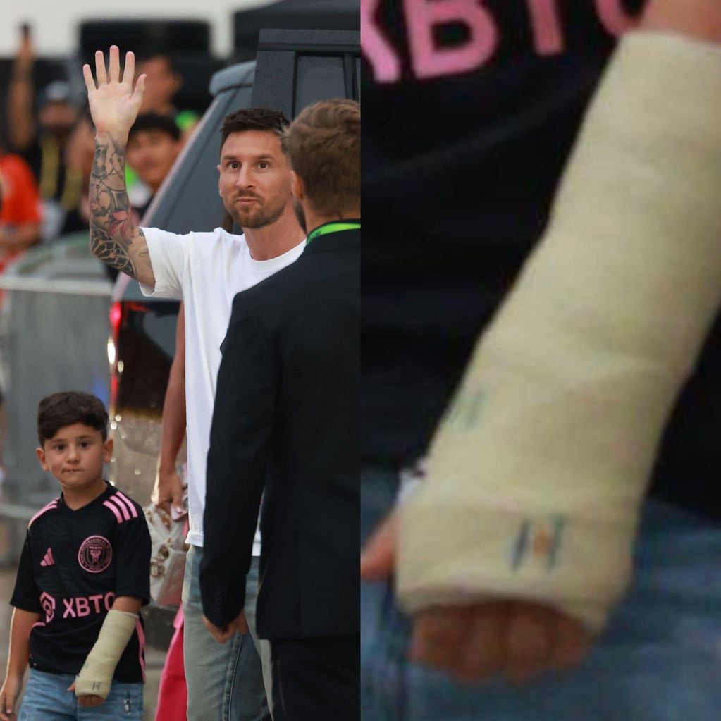 El yeso de Ciro Messi se volvió viral en las redes sociales.