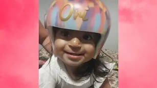 Oriana, la beba de San Luis que padece plagiocefalia, con su nuevo casco ortopédico.