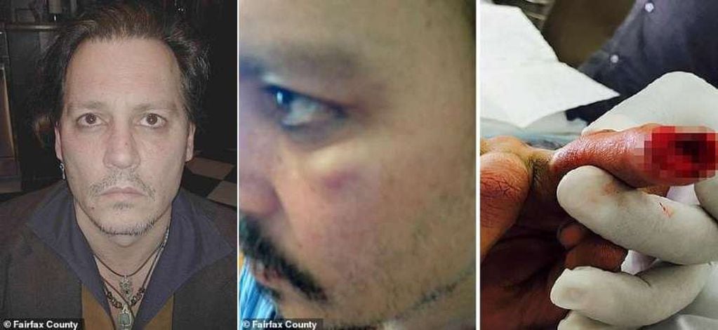 Las imágenes del día en que Johnny Depp se cortó el dedo en 2015.