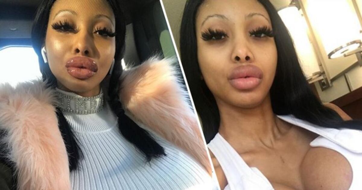 Ruby Doll Sunset, la joven que se hizo una cirugía estética para "desafiar la gravedad" Vía País