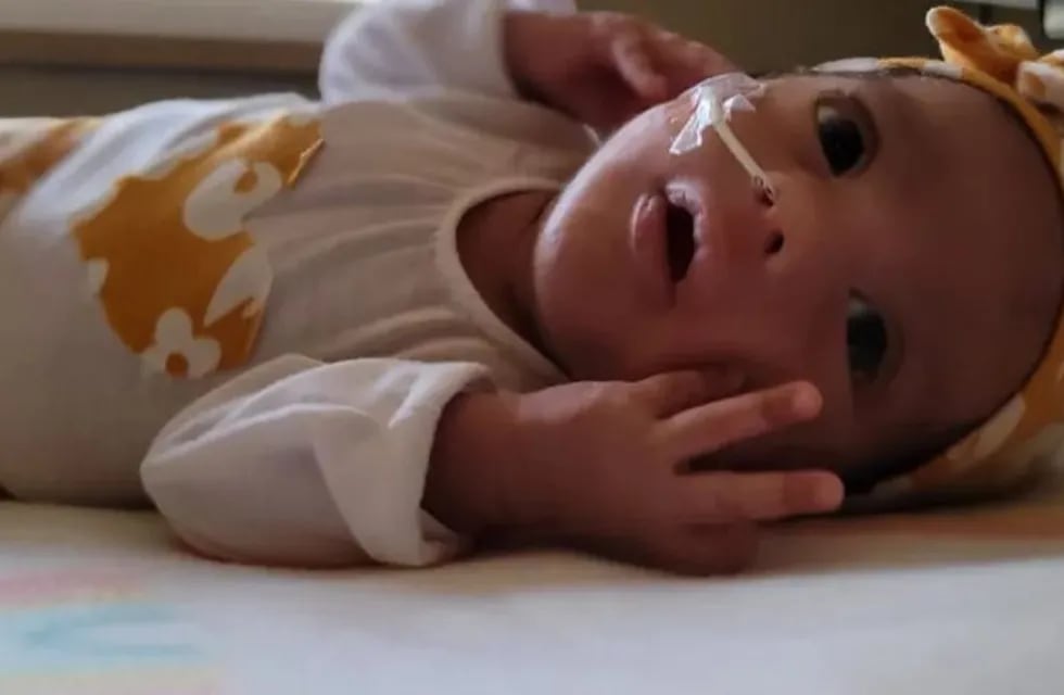 Ella es Evelyn, la bebé prematura santiagueña que lucha por sanar.
