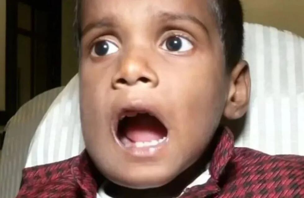 El joven hindú de 526 dientes (Foto: web).