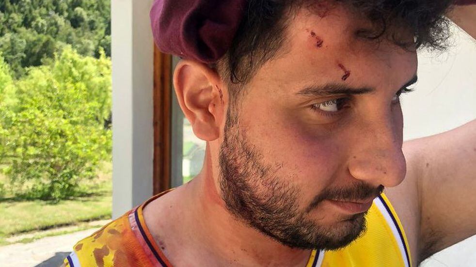 Uno de los jóvenes que fue golpeado en la cabeza el viernes en Villa Mascardi.