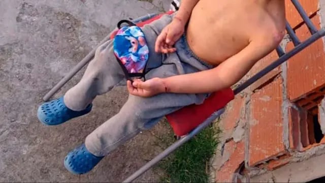 El nene atado con alambre en Moreno