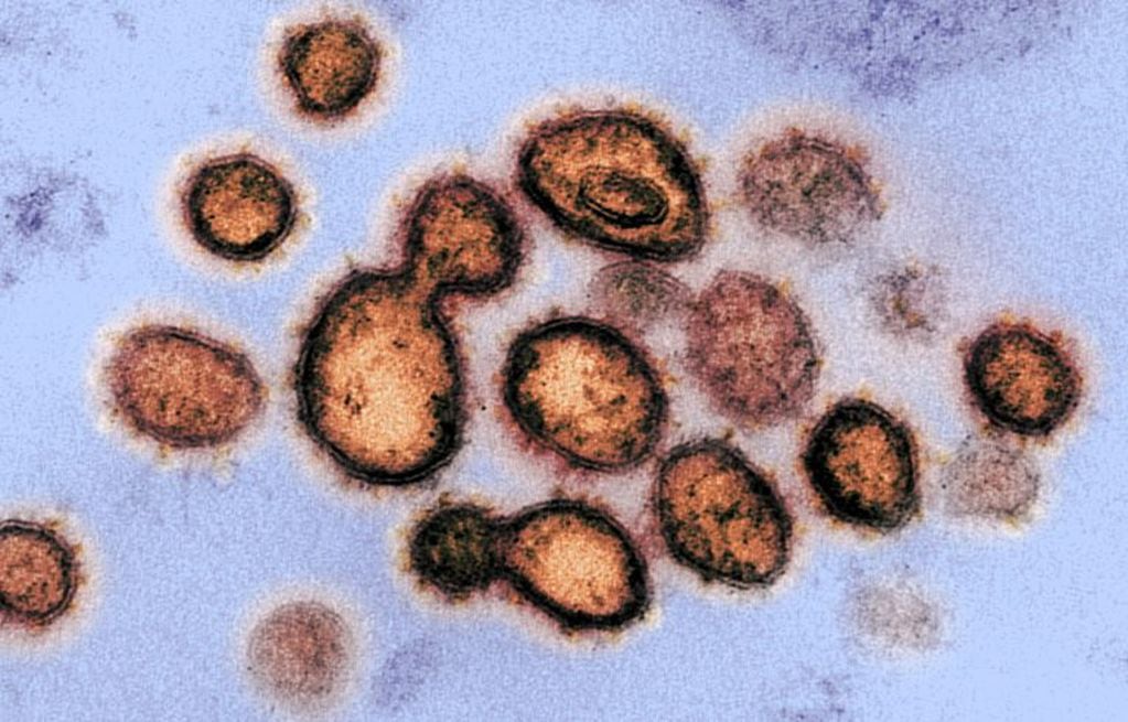 Vista del microscopio durante la transmisión del virus que causa el COVID-19. (Foto:EFE/EPA/NIAID- RML/NATIONAL INSTITUTES OF HEALTH)