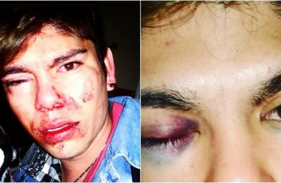 Entre Ríos: golpeó brutalmente a su compañero de escuela por ser homosexual