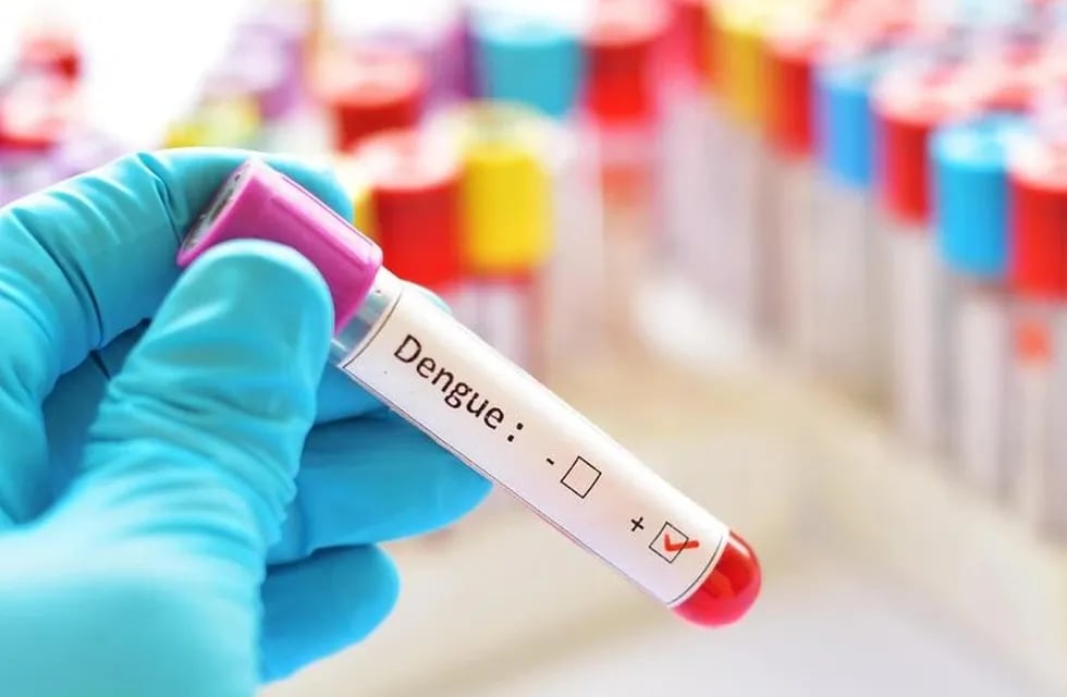 Test de detección del dengue.
