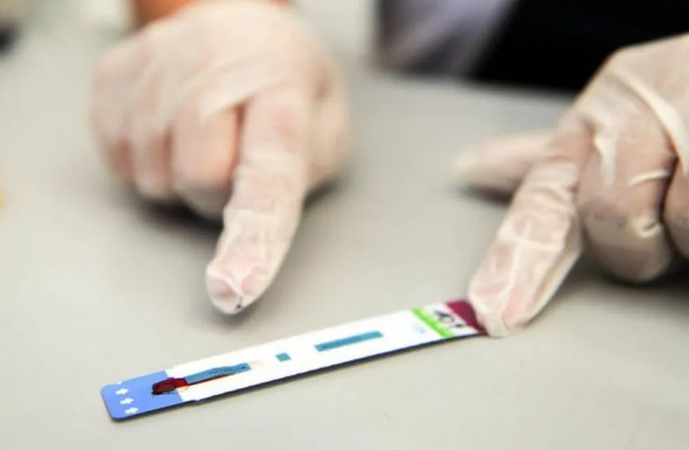 Testeos VIH Sida
