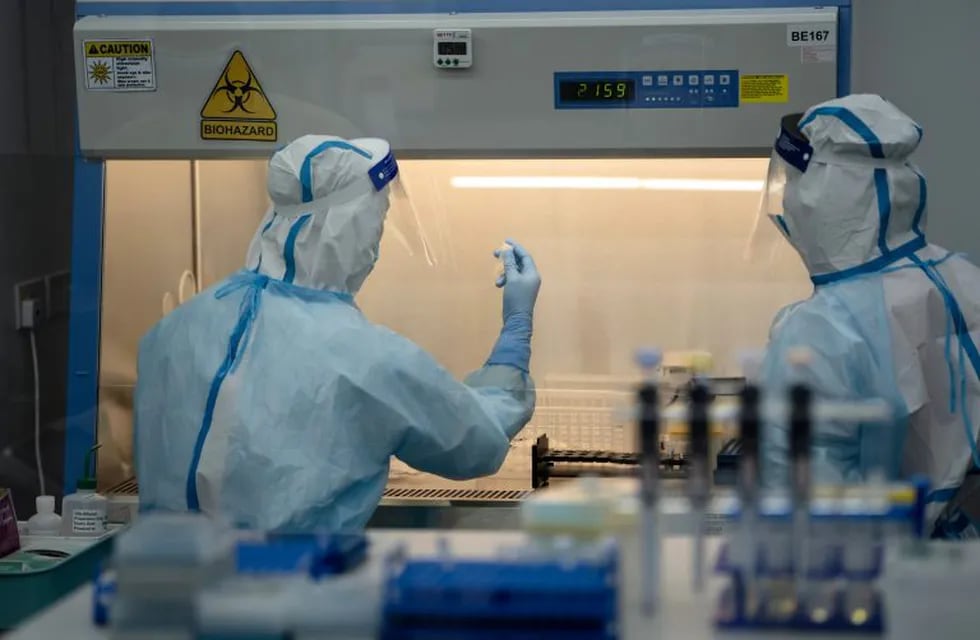 A lab technician wearing a protective suit holds up a saliva sample for RT-PCR Covid-19 testing at Prenetics Ltd.'s laboratory in Hong Kong, China on Friday, July 31, 2020. Prenetics, along with other Hong Kong labs and hospitals, has been overloaded with people seeking virus tests since the new wave emerged 18 days ago, Chief Executive Officer Danny Yeung said in an interview last month. Photographer: Roy Liu/Bloomberg
