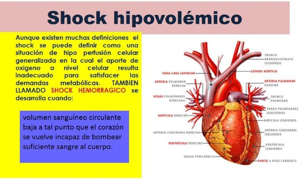 Carolina Torres Buenanueva, falleció por un shock hipovolémico, es decir, por pérdida grave de sangre.