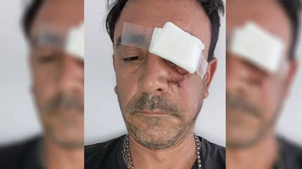 Mendocino fue atacado brutalmente por un limpiavidrios.