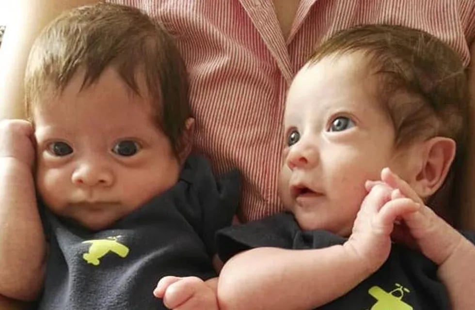Milo y Jano, los gemelos de siete meses que necesitan un trasplante de médula ósea (Foto: Facebook)