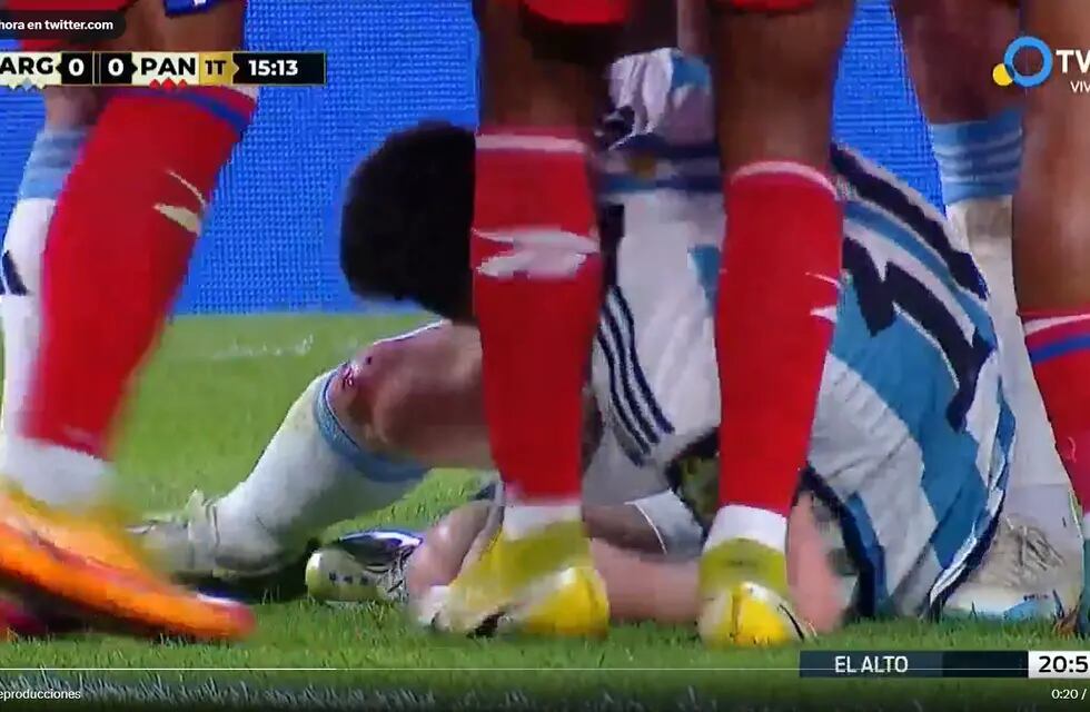 Amonestado Kevin Galván en Panama por una fuerte patada a Lionel Messi.