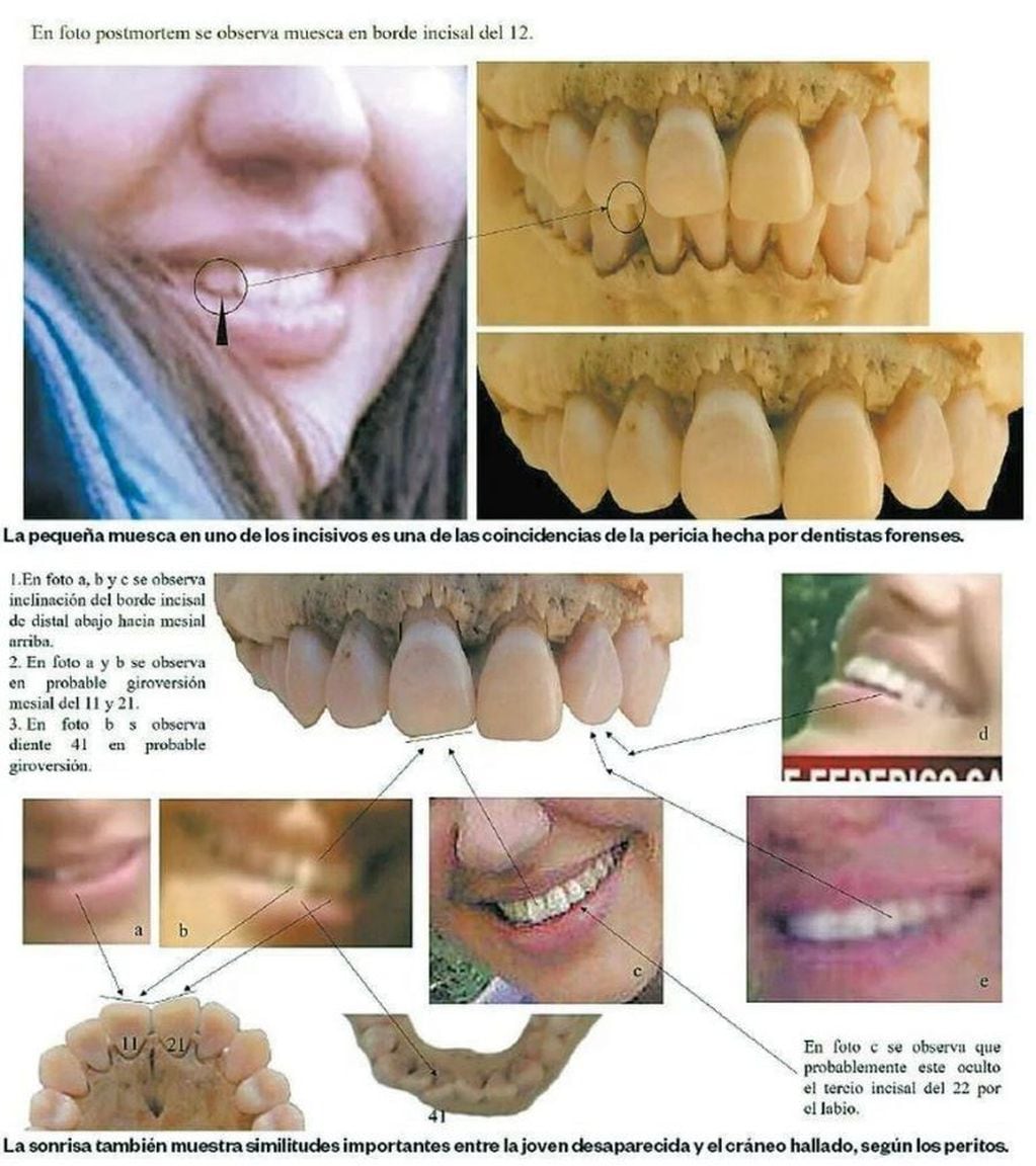 Dentistas forenses analizaron la sonrisa de María Cash y encontraron algunas similitudes con el cráneo hallado en Bolivia.