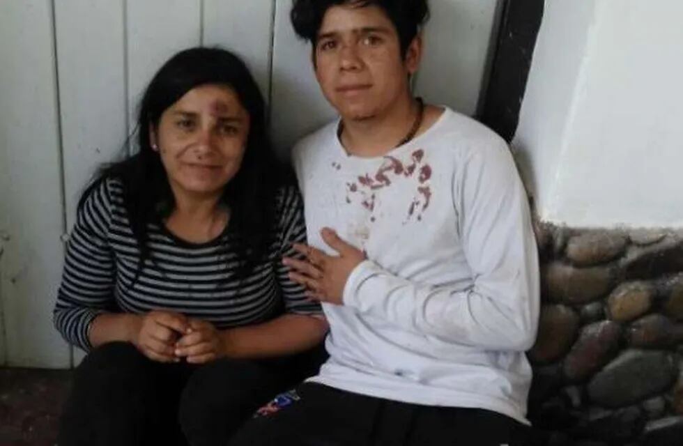 Desconsuelo, miedo, es lo que reflejan los rostros de Jason Contreras y su madre.