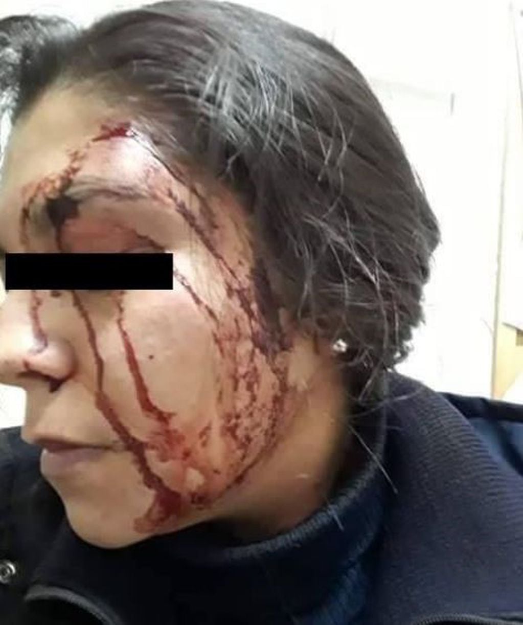 Una mujer policía de Corrientes fue brutalmente atacada por una patota. (Foto: Época)