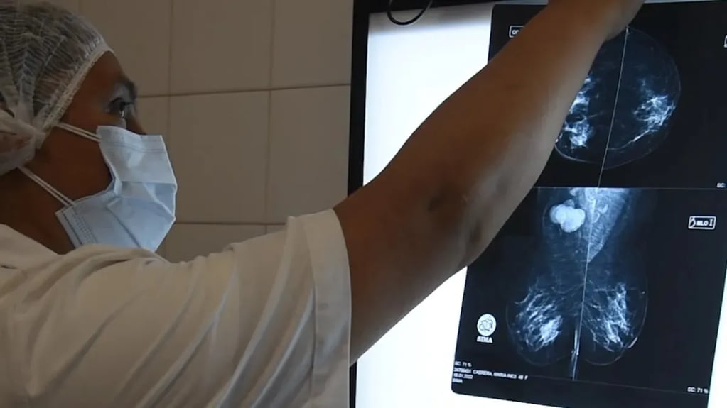 La mamografía es el estudio clave para un diagnóstico precoz y debe realizarse de manera anual a partir de los 40 años de edad. En Jujuy se detecta un promedio de 180 casos al año.