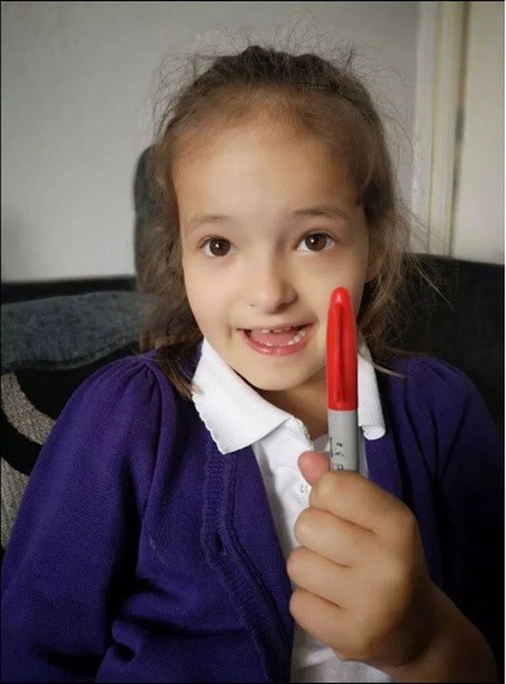Lily Schooley, una niña inglesa de seis años, quiso evitar un examen y se pintó manchas rojas en la piel con marcador permanente. (foto: Facebook)