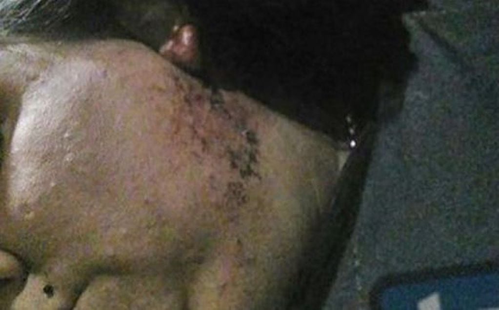 Las heridas que sufrió Mariela Aquino por el brutal ataque