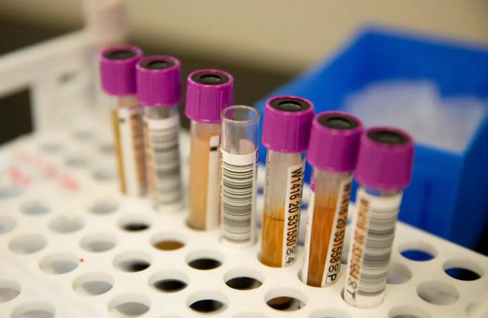 Convalescent plasma samples in vials are seen before being tested for COVID-19 antibodies at the Bloodworks Northwest Laboratory during the coronavirus disease (COVID-19) outbreak in Renton, Washington, U.S. September 9, 2020. Picture taken September 9, 2020.  REUTERS/Lindsey Wasson