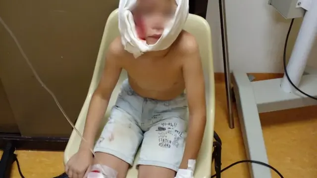 Oberá: un niño de 7 años resultó seriamente herido tras el ataque de un perro rottweiler