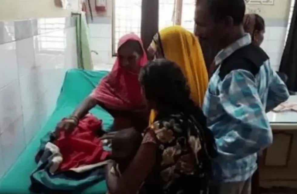 Conmoción en India por el nacimiento de un bebé con tres cabezas