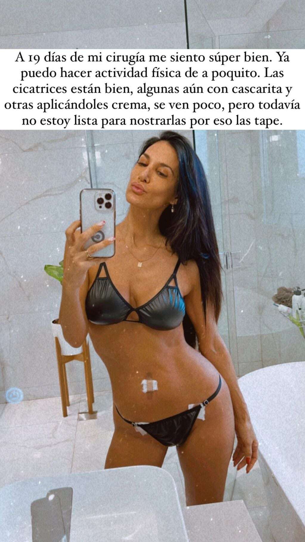 Qué le pasó a Silvina Escudero. / Instagram