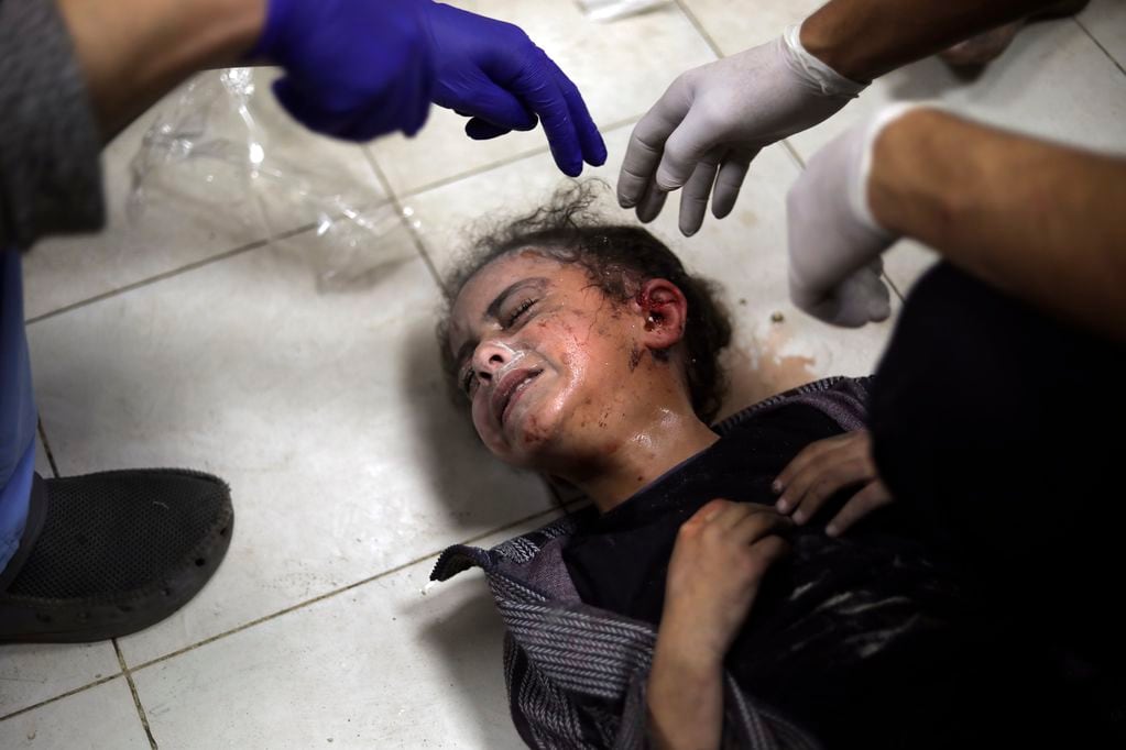 Una niña herida durante un bombardeo israelí de la Franja de Gaza recibe tratamiento en el hospital Nasser en Jan Yunis, en el sur de la Franja de Gaza, el sábado 6 de enero de 2024. 