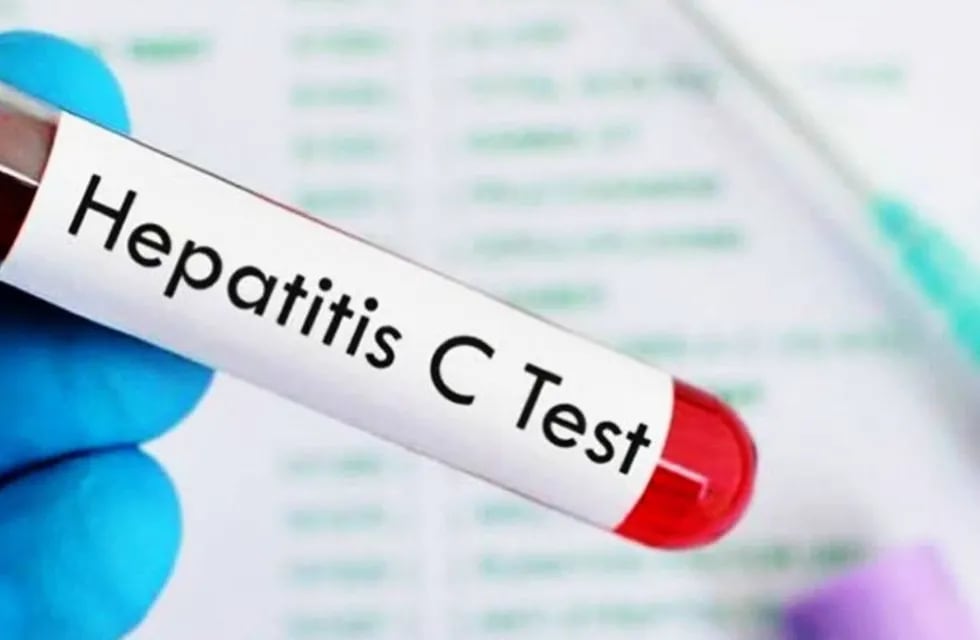 Hepatitis C: Mendoza es parte de la campaña nacional de concientización y detección gratuita.