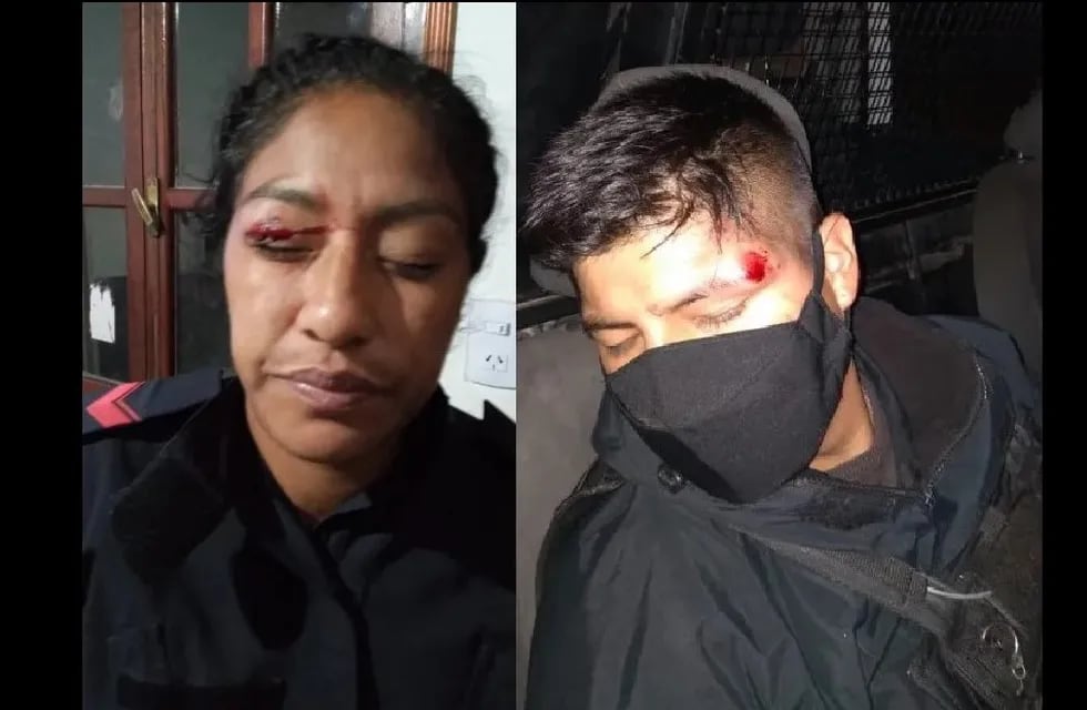 Dos de los cinco policías que resultaron heridos y lesionados durante un operativo de prevención en el barrio Campo Verde el 8 de marzo pasado.