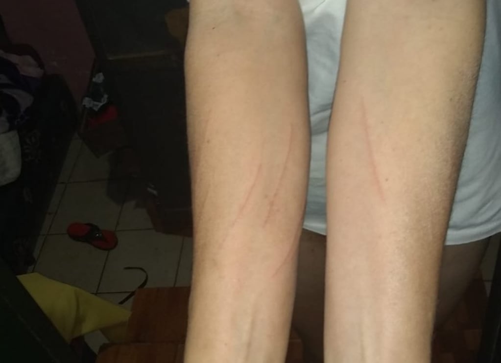 Una mujer denuncia violencia física por parte de sus vecinos en Puerto Iguazú.