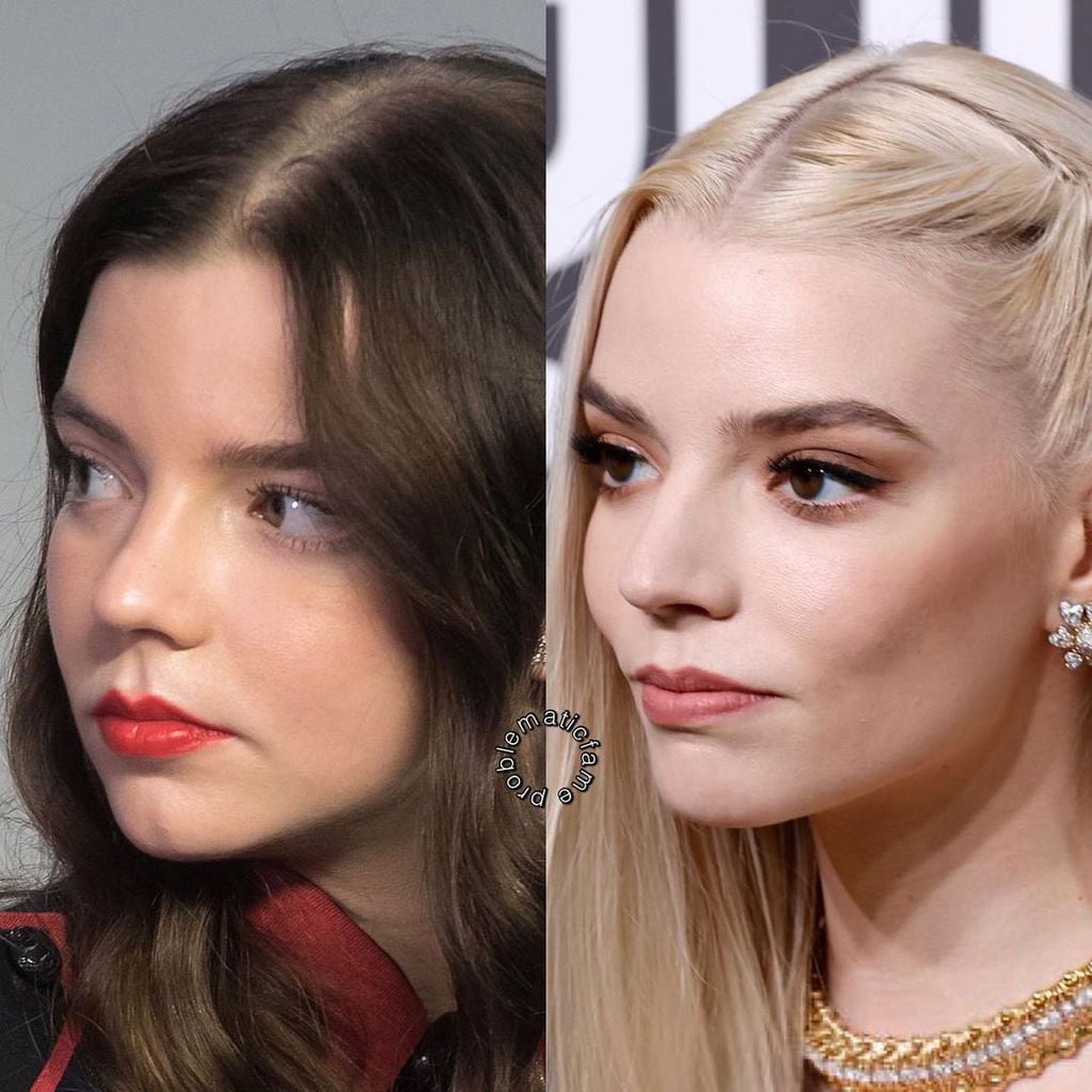 Un usuario de Instagram comparó el rostro de Anya Taylor-Joy en 2016 y ahora