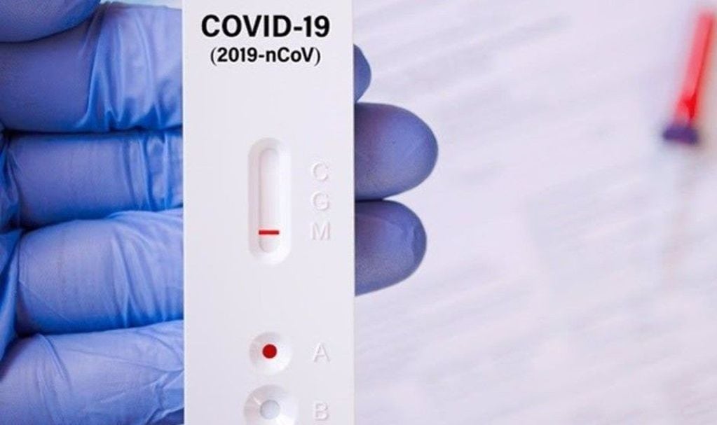 Los autotest para detectar coronavirus se aplican en varios países desde hace un tiempo.