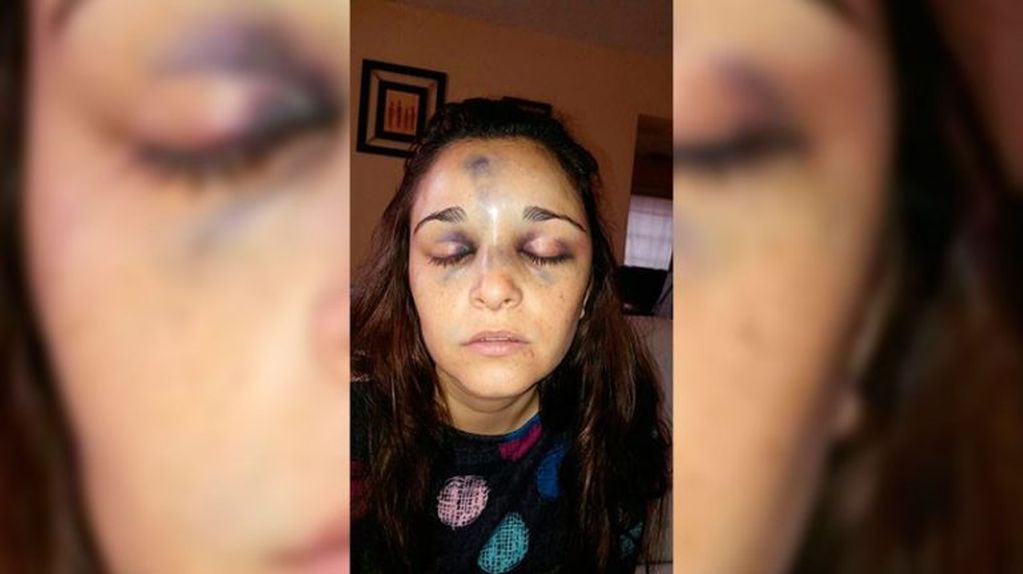 Carla Pereira, chica golpeada en san Luis.