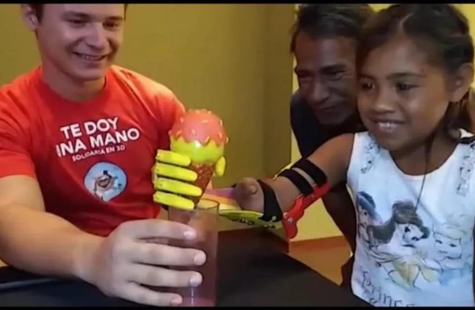 Lilian Ojeda recibió una mano ortopédica hecha con impresoras 3D de parte de la fundación \