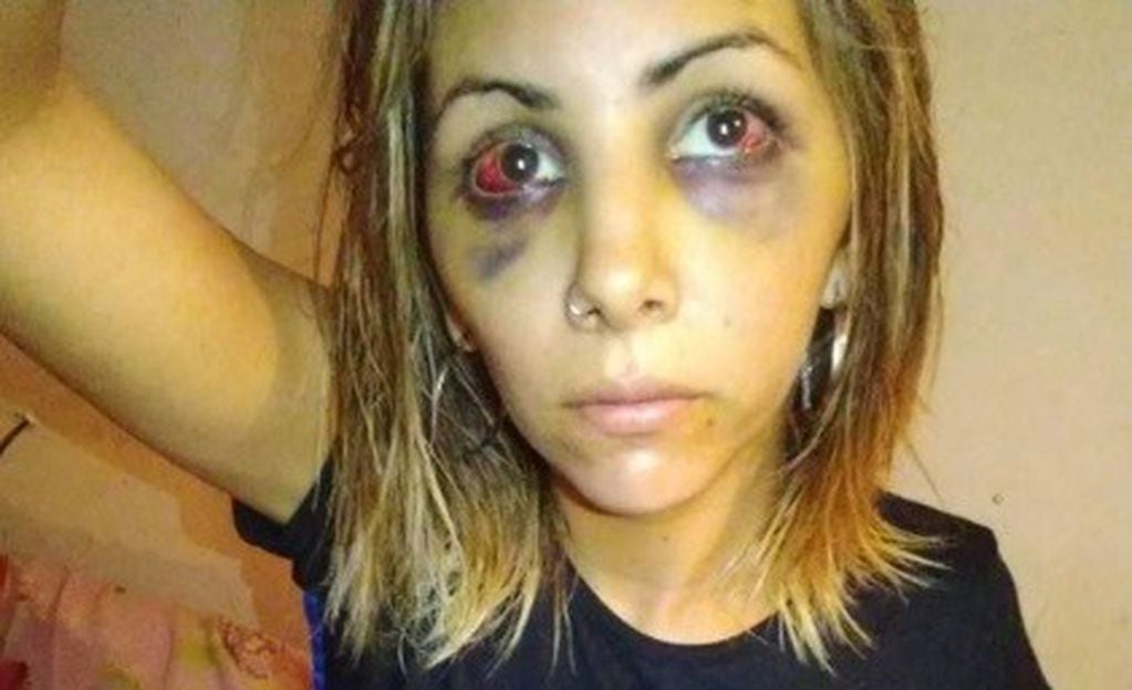 Magalí Lencina fue golpeada brutalmente por su ex novio (Facebook Magalí Lencina)