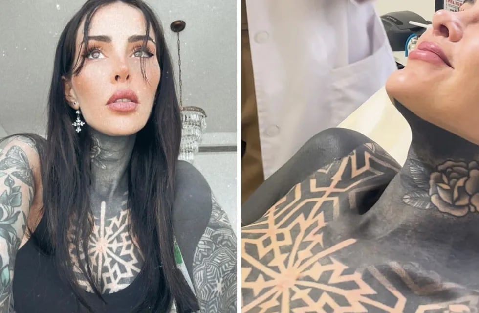 Cande Tinelli se borró un tatuaje: cómo es y qué tanto duele el procedimiento.