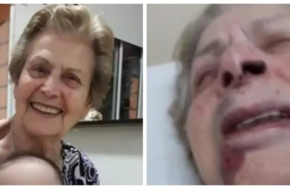Golpearon brutalmente a una anciana para robarle la jubilación