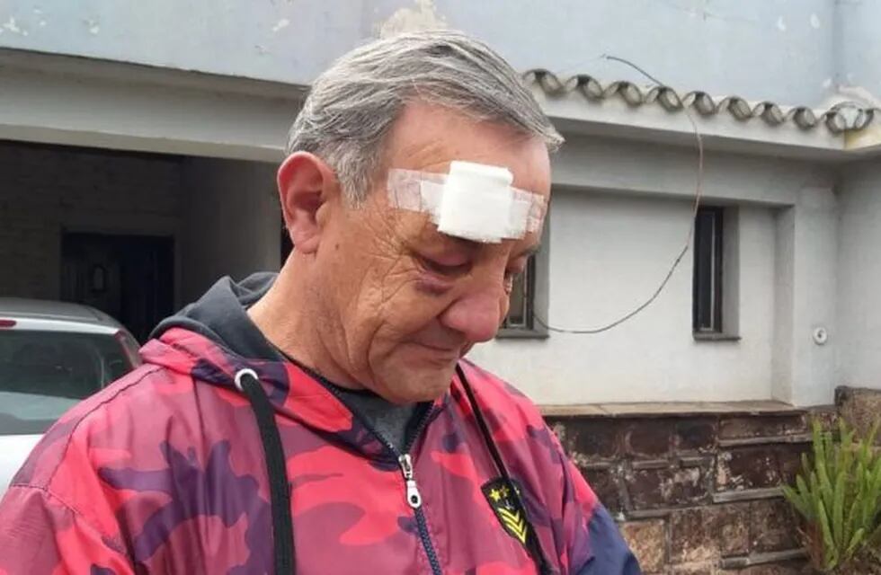 Vecino atacado por una patota en Río Cuarto