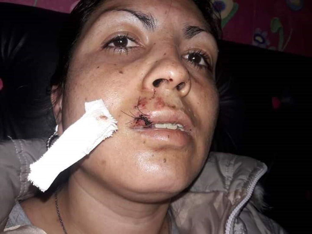Janet Agüero, la joven de 27 años muestra su rostro tras la pelea en un barrio de La Falda. (Foto: gentileza Janet Agüero).