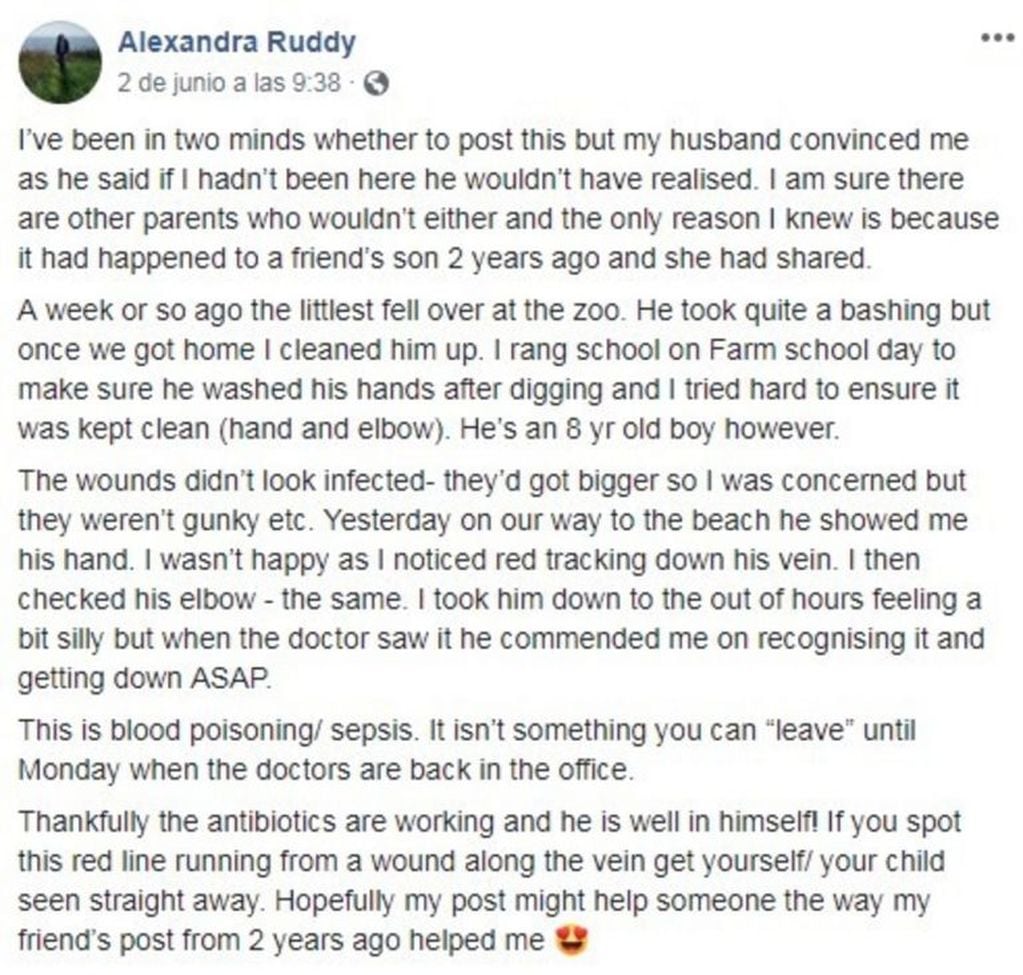 Descubrió una extraña marca roja en el brazo de su hijo y sin saberlo le salvó la vida (Foto: Facebook)