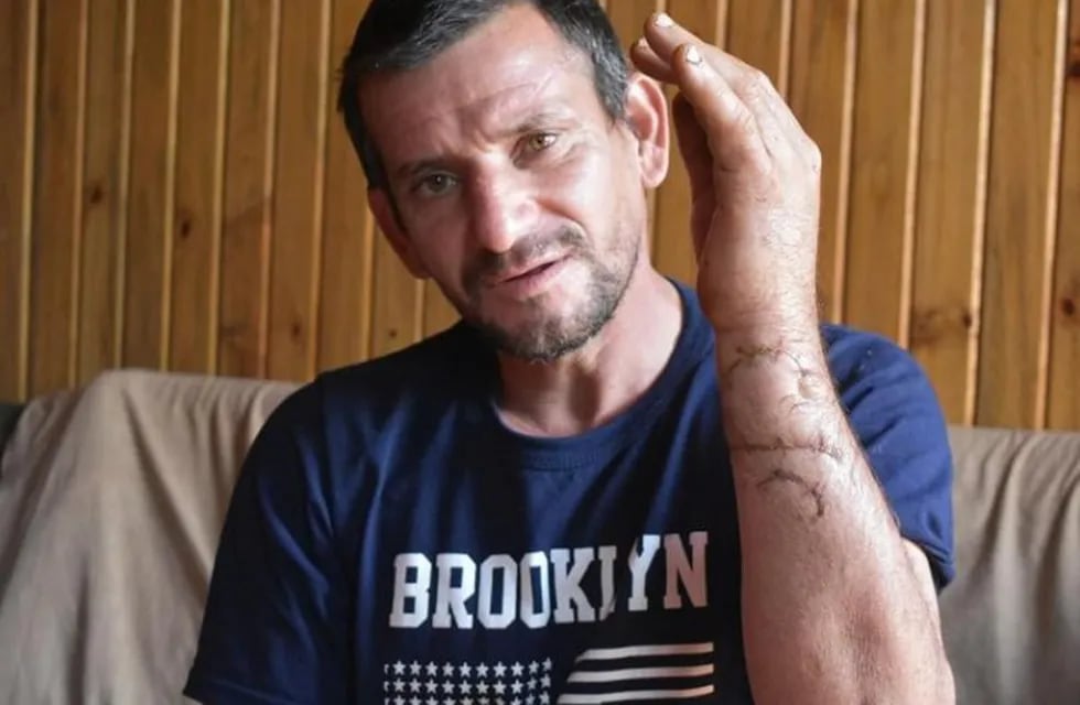 Ramón Alberto Espínola logró escapar de sus atacantes pero le costaría la movilidad en mano izquierda debido a las heridas recibidas.