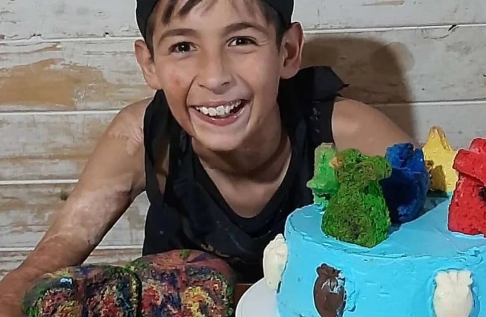 Joaquín Nahuel, quien ahora tiene 13 años, se hizo viral por vender tortas para la operación de piel que necesita.